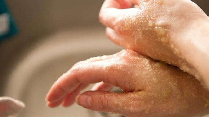Мои руки были морщинистыми, как у дряхлой ведьмы, пока я не узнала эти средства! 2-110-8294728