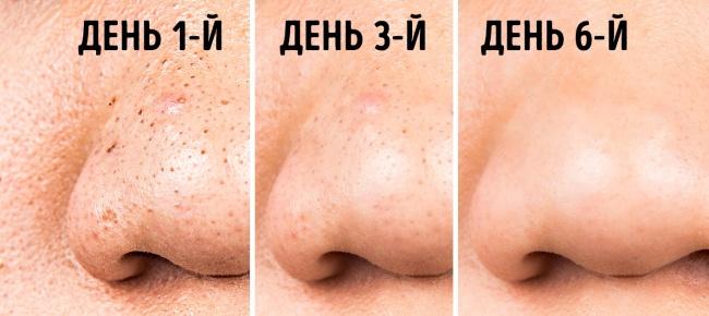 19 неочевидных идей применения эфирных масел, о которых вам, скорее всего, не рассказывали 3-152-9637300
