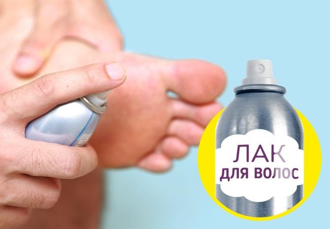 15 простых способов без лишних трат привести вашу обувь в порядок 4-29-1-1931172