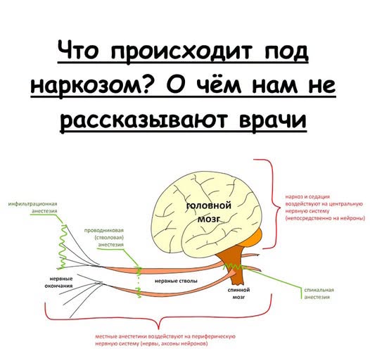 Что происходит под наркозом? О чём нам не рассказывают врачи.