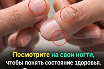 Как по состоянию ногтей определить наличие проблем со здоровьем