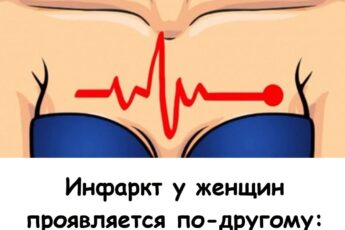 Не пропустите эти 5 сигналов! Как проявляется инфаркт у женщин