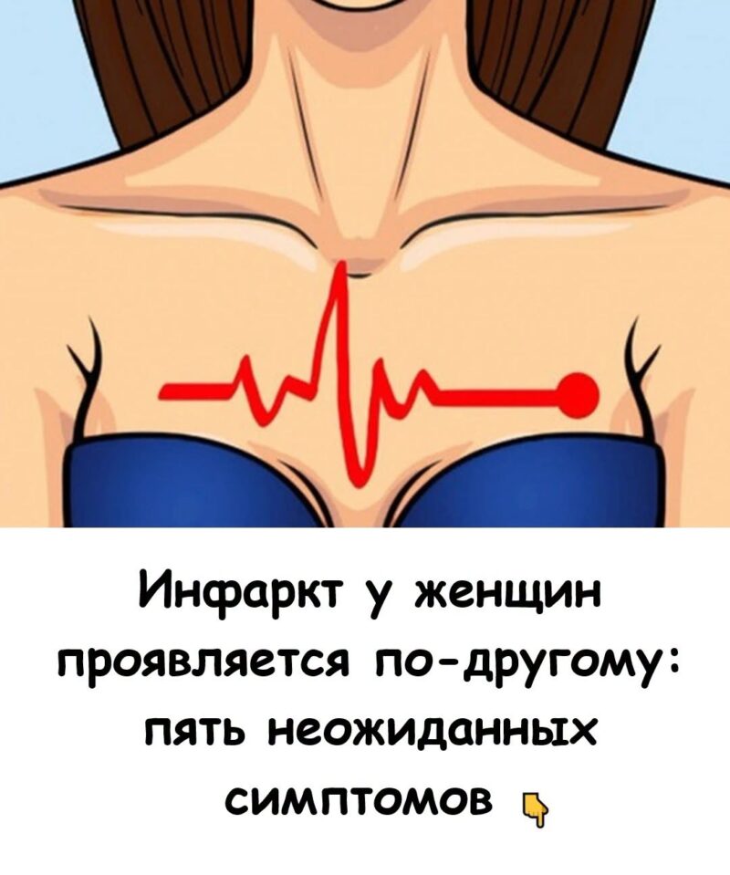 Не пропустите эти 5 сигналов! Как проявляется инфаркт у женщин Не пропустите эти 5 сигналов! Как проявляется инфаркт у женщин